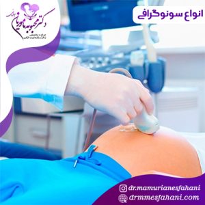 انواع سونوگرافی برای زنان
