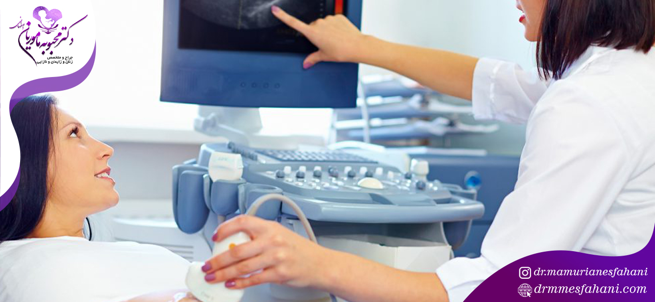 انواع سونوگرافی برای زنان