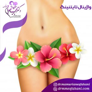 واژینال تایتنینگ