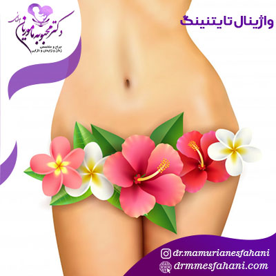 واژینال تایتنینگ