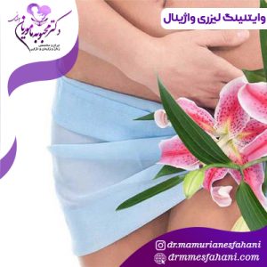 واژینال وایتینگ لیزری(سفیدی)