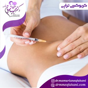 کربوکسی تراپی در بانوان چیست؟