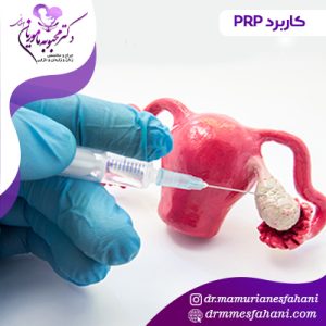 کاربردهای پی آرپی چیست ؟