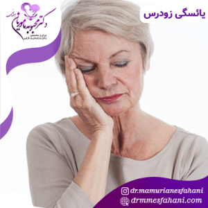 یائسگی زودرس