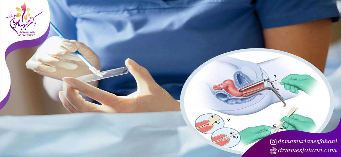 نتیجه تست پاپ اسمیر