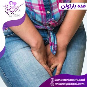 غده بارتولن