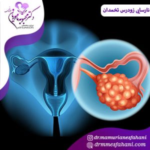 نارسایی زودرس تخمدان