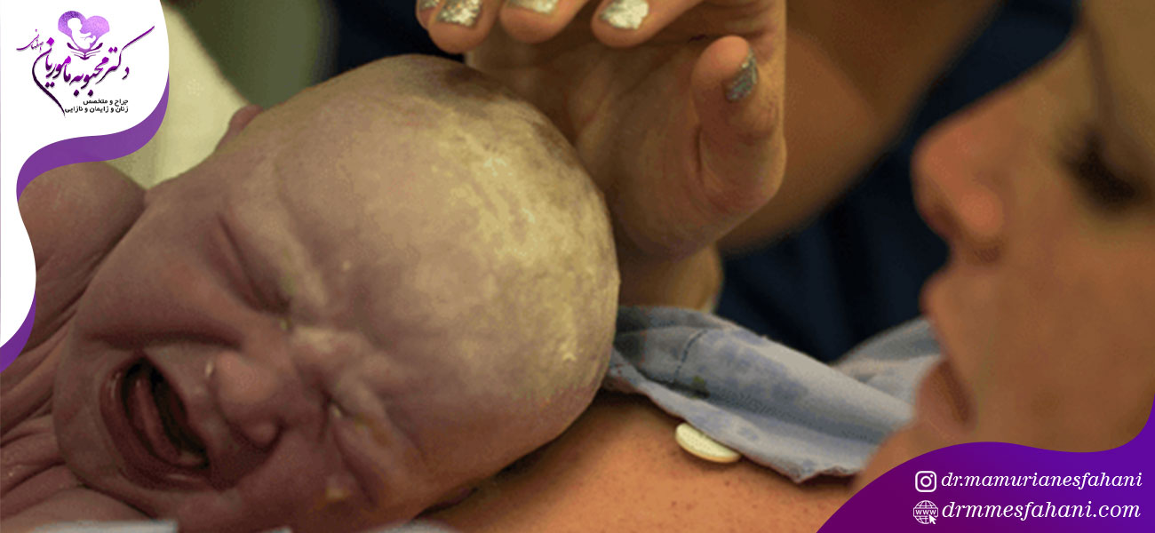 زایمان در میرداماد