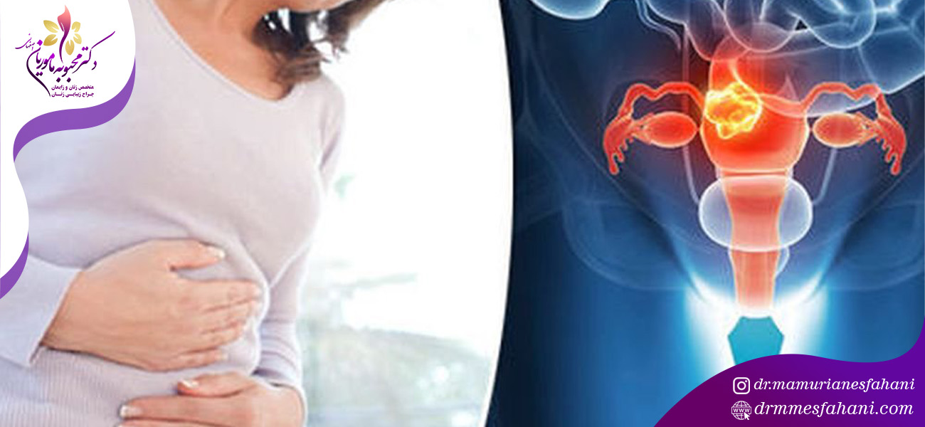 تشخیص فیبروم رحم