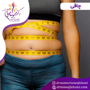 تاثیر منفی چاقی در سلامت زنان