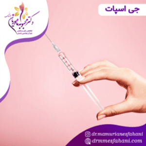 روش های ایمن برای برجسته کردن جی اسپات با تزریق