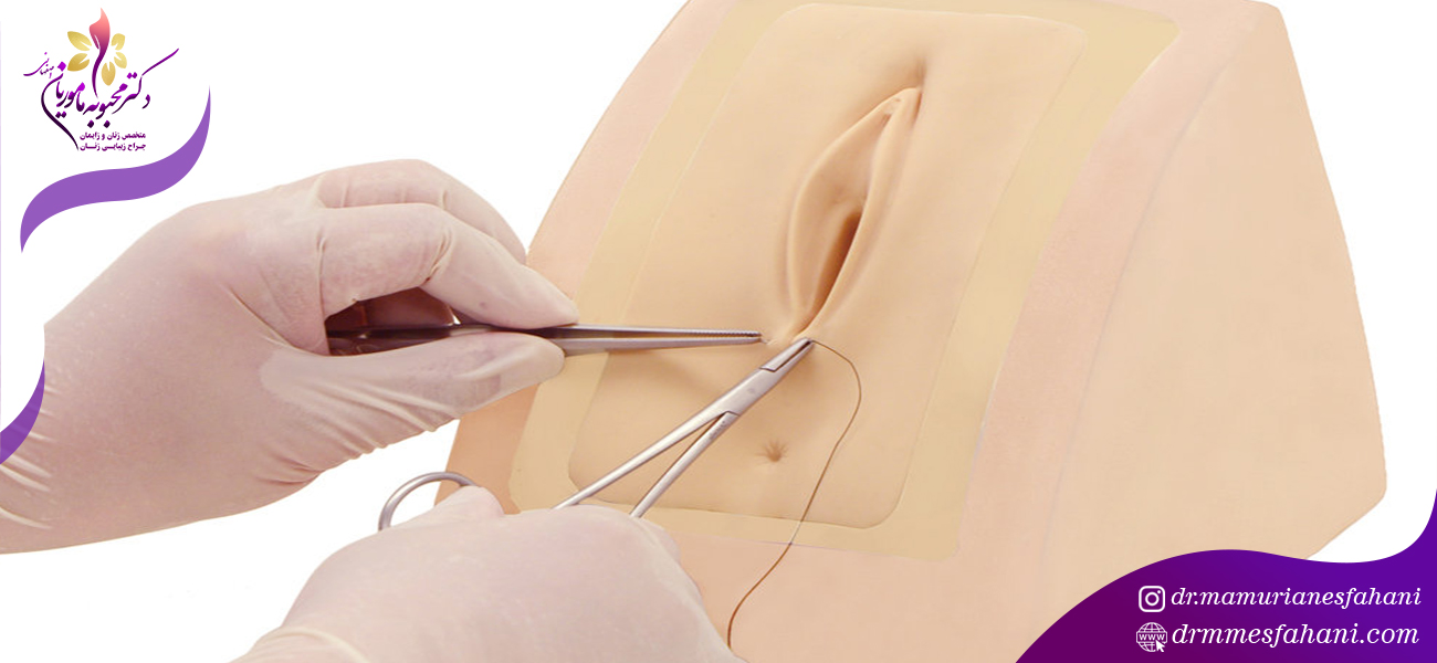 پرینورافی فرایندی زیبایی است یا درمانی؟