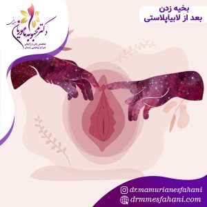 بخیه زدن بعد از لابیاپلاستی