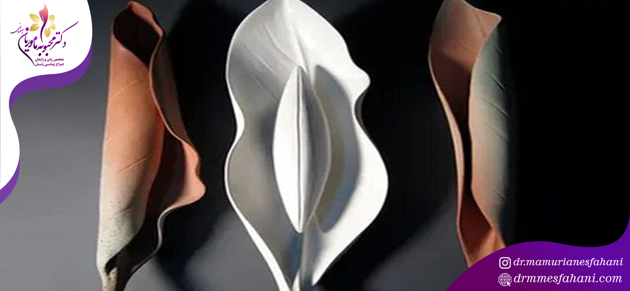 زمان افتادن بخیه ها بعد از لابیاپلاستی