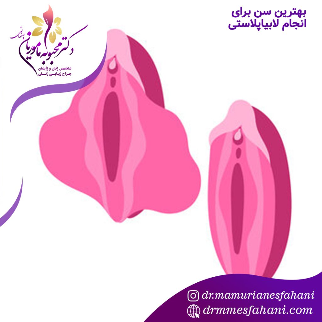 بهترین سن برای انجام لابیاپلاستی