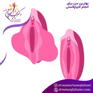 بهترین سن برای انجام لابیاپلاستی