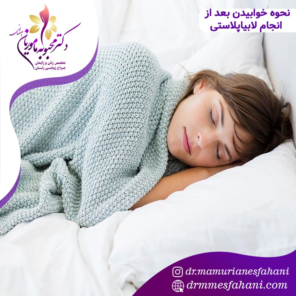 نحوه خوابیدن بعد از انجام لابیاپلاستی