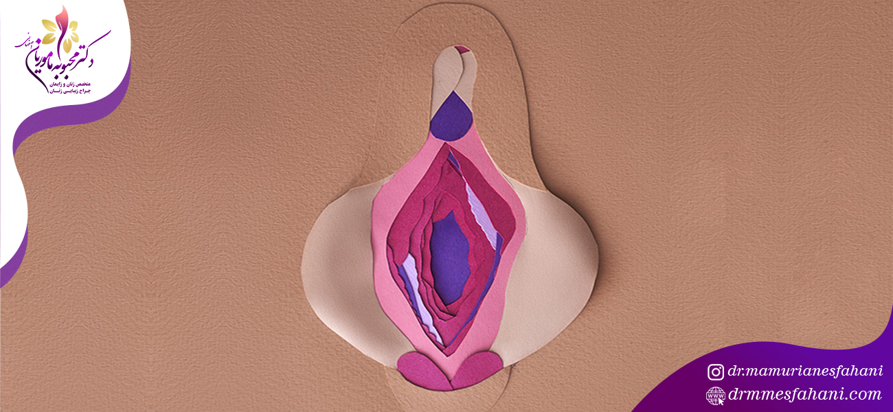 نکات قابل توجه بعد از انجام لابیاپلاستی