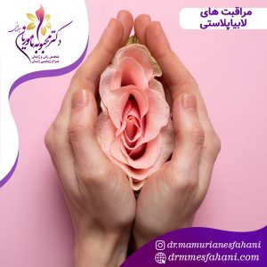 مراقبت های بعد از لابیاپلاستی