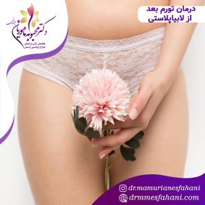 درمان تورم بعد از لابیاپلاستی