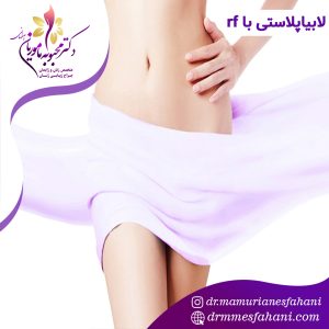 لابیاپلاستی با دستگاه rf