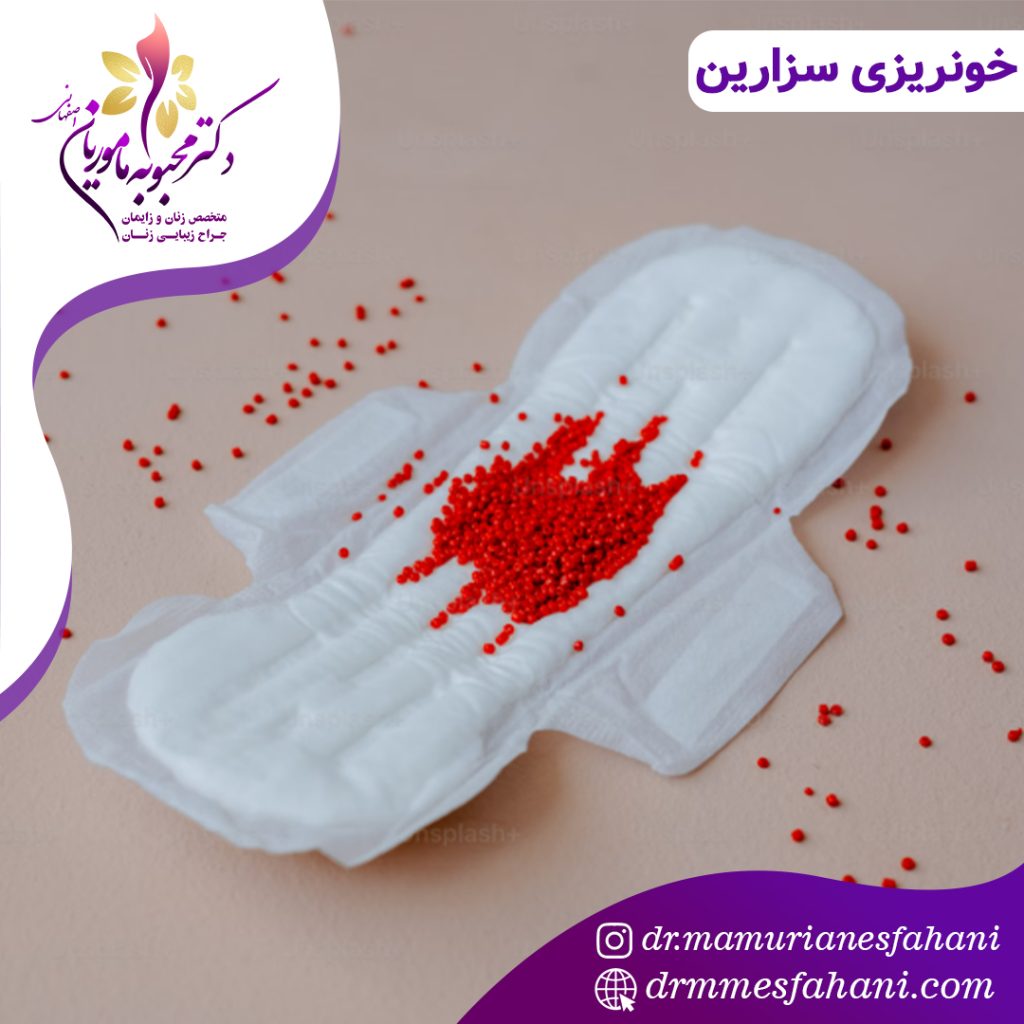 خونریزی بعد از زایمان سزارین